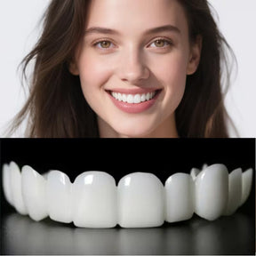 Facetas Dentárias Removíveis SorrisoFlex